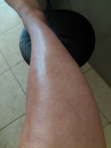 Customer result photo